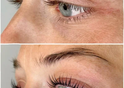 Wimpernlifting
