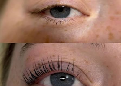 Wimpernlifting