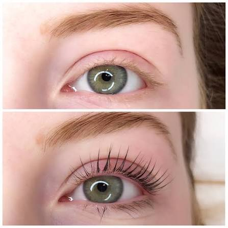 Wimpernlifting