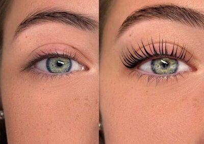 Wimpernlifting