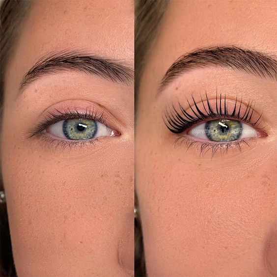 Wimpernlifting