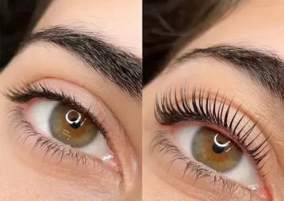 Wimpernlifting